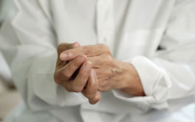 What Are the Stages of Rheumatoid Arthritis?