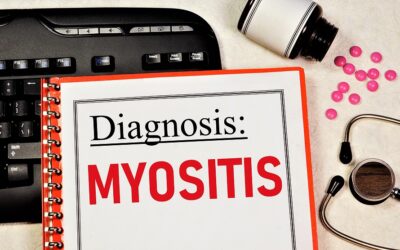 Symptoms of Myositis and How to Spot Them