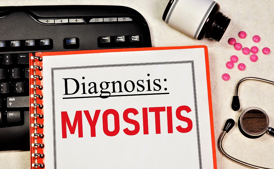 Symptoms of Myositis and How to Spot Them