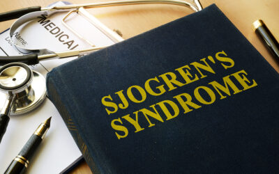 Understanding Sjogren’s Syndrome: Symptoms, Diagnosis, and Treatment Options