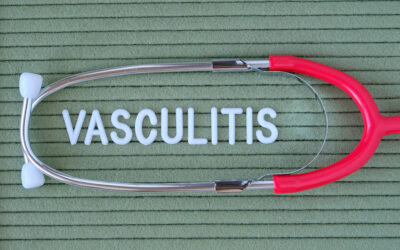 What Are the Causes of Vasculitis?