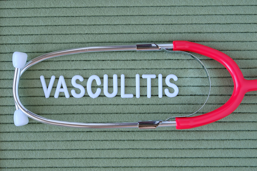 What Are the Causes of Vasculitis?