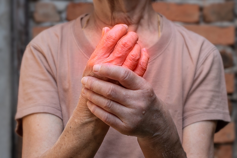 Uncommon Gout Symptoms You Might Be Ignoring